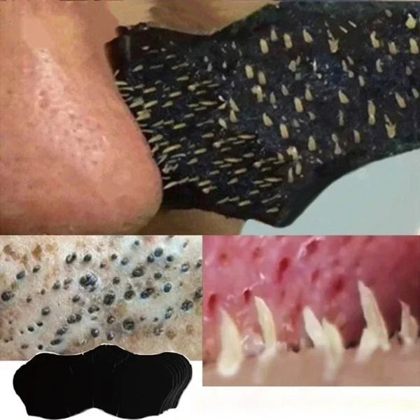 Charcoal Deep-Clean Nose Strips